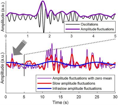 Breakdown of long-range spatial correlations of infraslow amplitude fluctuations of EEG oscillations in patients with current and past major depressive disorder